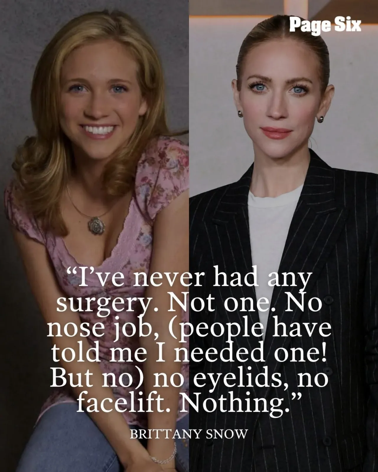 Brittany Snow Addresses Plastic Surgery Claims After Viral Instagram Post